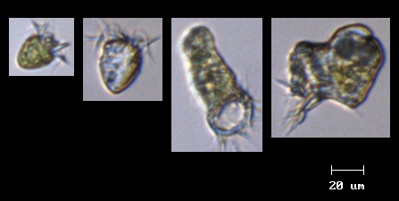 Oligotrich ciliates_9nov