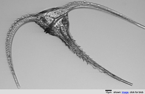 Picture of a ceratium taken by the IFCB