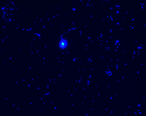 Image of marine bacteria and flagellates.  Photo by C. Carlson.