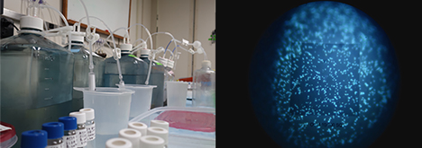 Left: Sampling some of our growth experiments to quantify DOM, cell numbers, cell carbon content, DNA, and enzyme activity. Right: Microscopic view of marine bacteria from our growth experiments, fluorescing with a nuclear counterstain.  