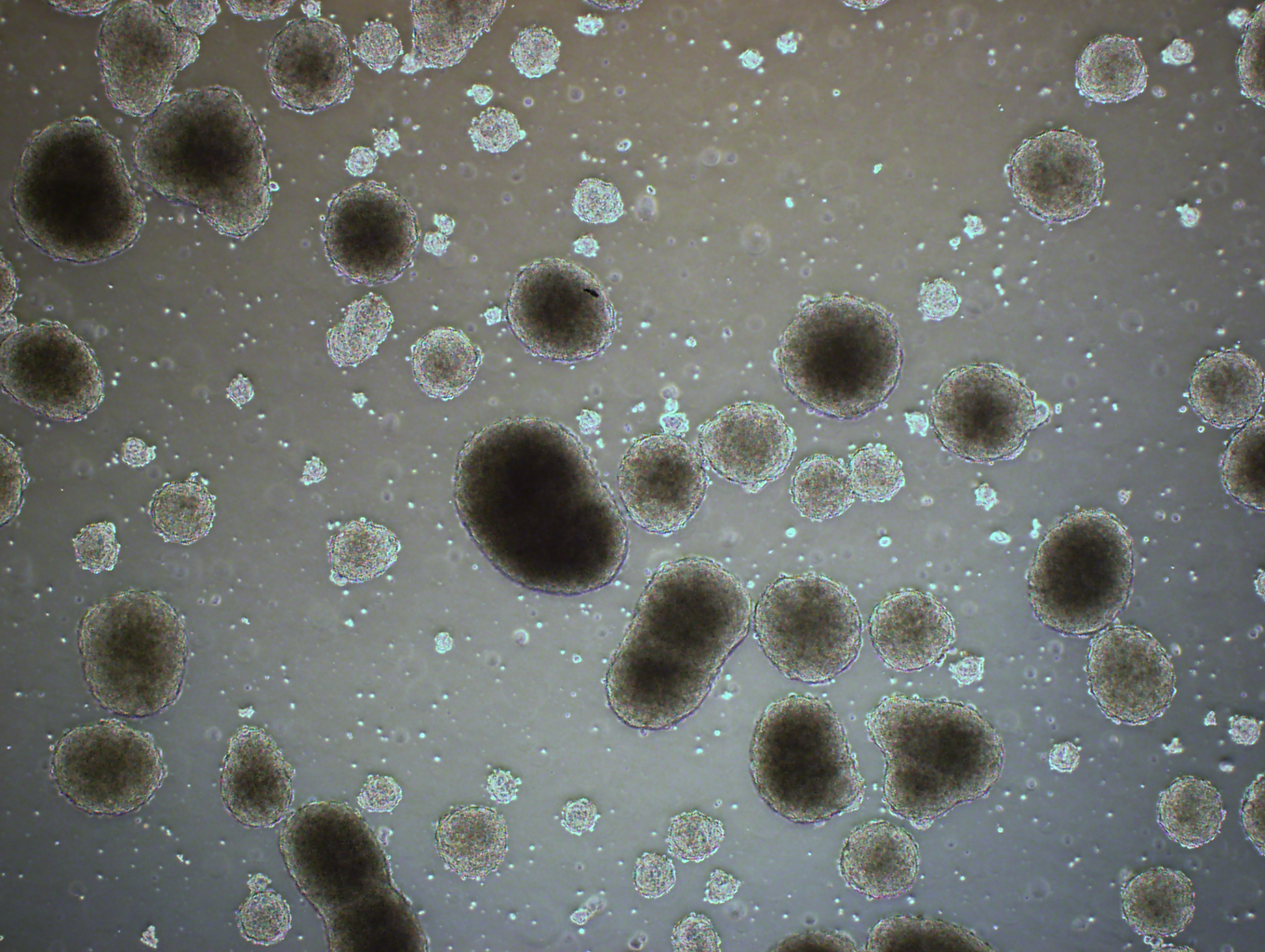 A scattering of brown-colored cells in a variety of sizes.