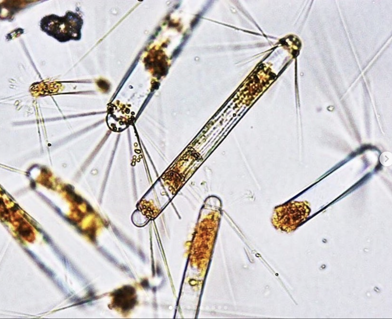 Image shows several clear, skinny cylinders with spikes radiating from either end. Each cylinder contains one or more areas of irregular, brown-gold material. As is typical of images made through a microscope, only a narrow plane in the image is in focus, with objects nearer or farther from the plane appearing out of focus.