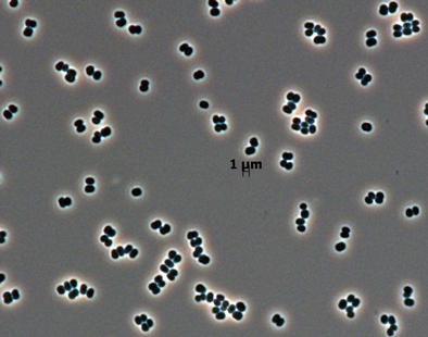 This microscopic image shows dozens of individual bacterial cells of the recently discovered species Tersicoccus phoenicis.