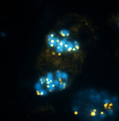 Blue blobs are illuminated under a microscope on a black background. Small yellow, fluorescent dots are scattered throughout the blue blobs.
