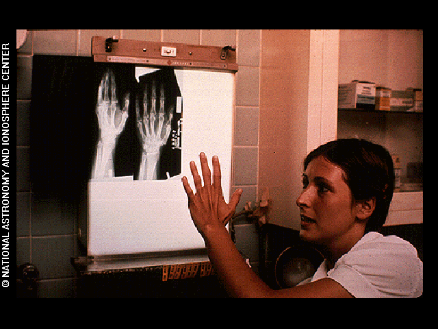 A person placing a hand against a X-ray viewer next to an X-ray image of bones inside a hand
