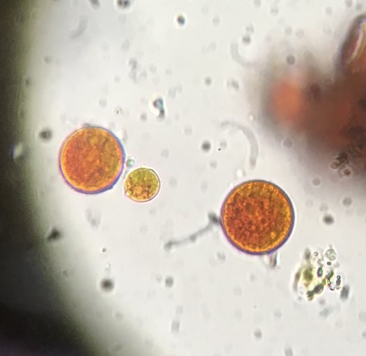 Under a microscope, two large, circular, rust colored organisms can be seen toward the middle of the frame. Similar cells are out of focus to the right edge. Other flecks of small dust are also seen against the white backdrop.