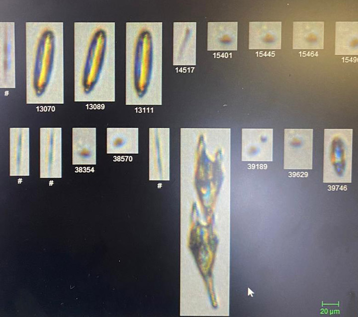 A spectacular image of the ER-2 aircraft doing a flyby at Walvis Bay International Airport on August 26, 2016. Photo by Brian Rheingans.